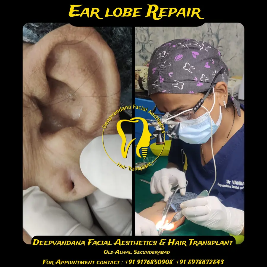 Earlobe repair procedure