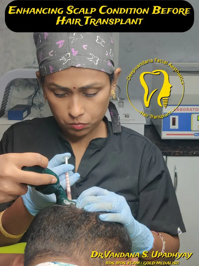 Scalp preparation before hair transplant